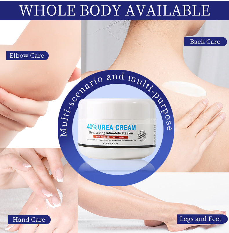 40% Urea Cream - Specifically for Hyperkeratosis, Ichthyosis, Psoriasis, and Eczema