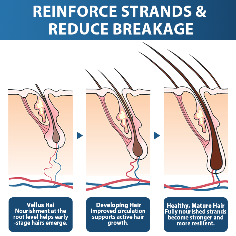 ✅🇺🇸 Developed by Trichologists:High-Concentration Minoxidil Hair Regrowth Serum