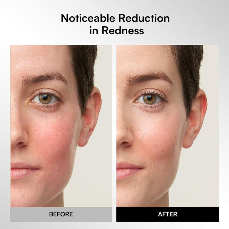 GLOW Wireless LED Face Mask,Portable and Rechargeable