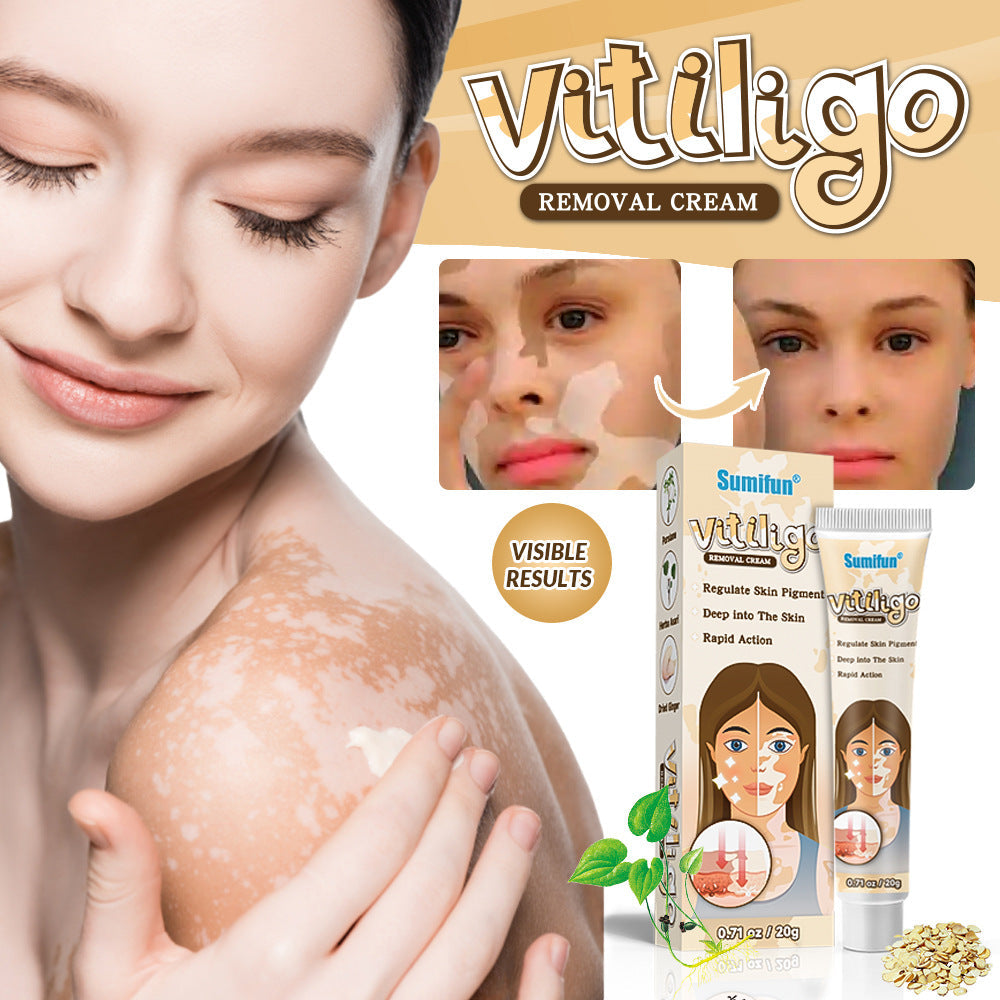 Vitiligo Repair Cream