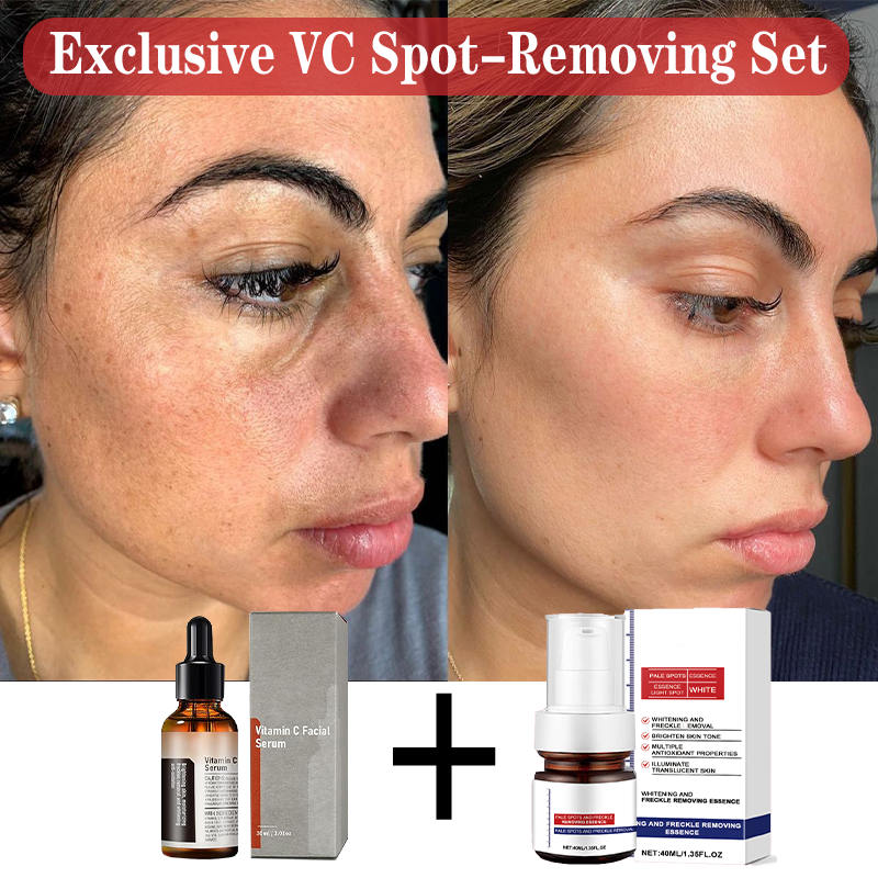 【Dermatologist-Recommended】 VC Spot-Correction & Whitening Cream Set