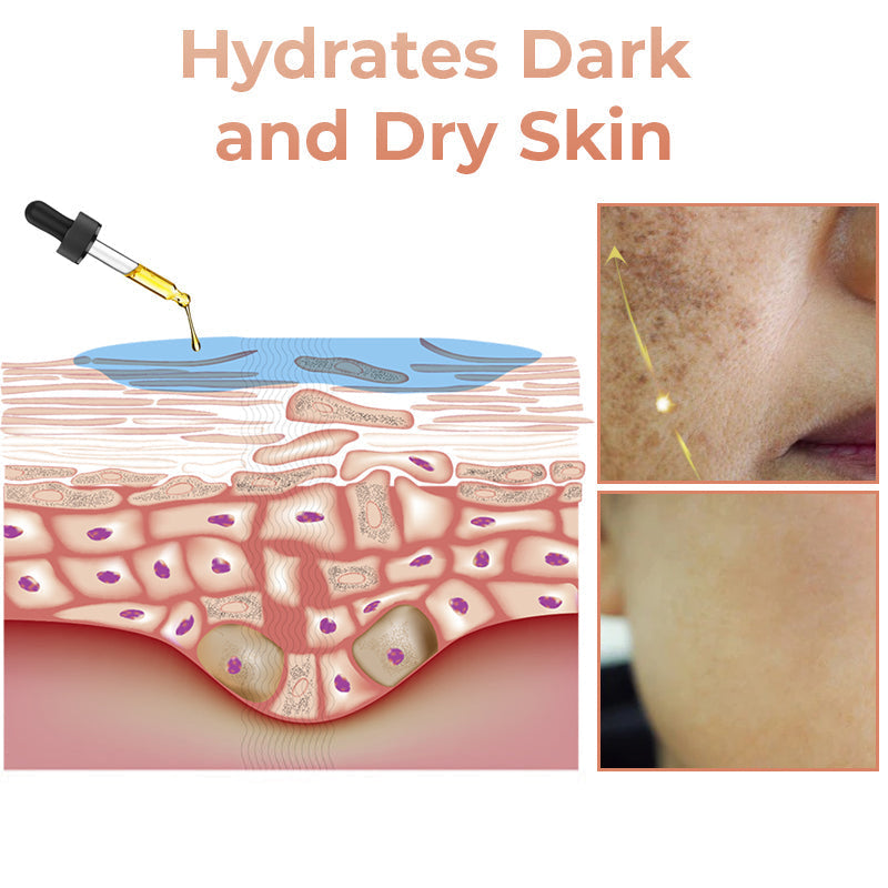 ✨Fast Dark Spot Remover- Melanin Correcting Facial Serum