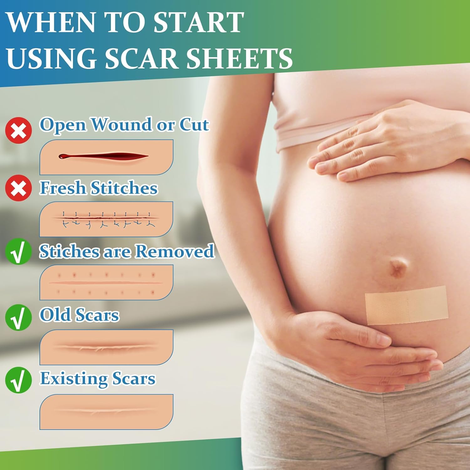 Scar Solution Set – Scar Cream Gel + Silicone Scar Tape