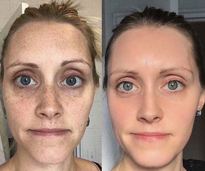 Éternelle Lumière Collagen Spot-Correction & Youth Renewal Collection