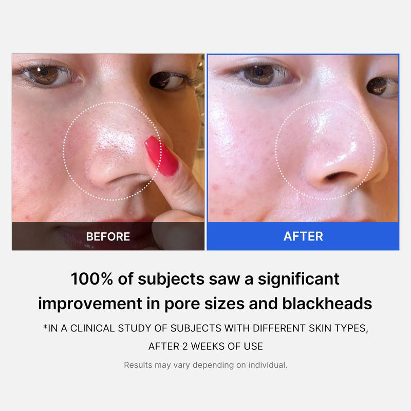Mirco Pore Pads (AHA + BHA) |Acne-prone skin care