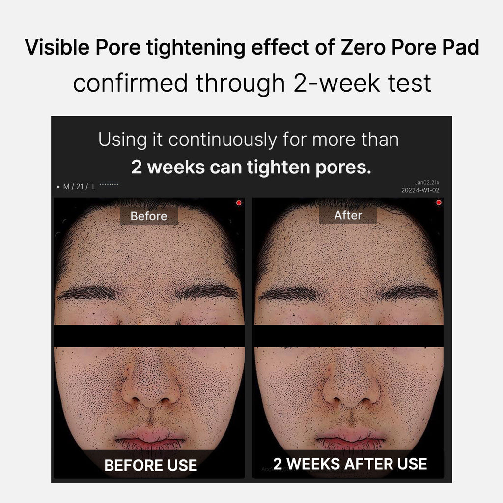 Mirco Pore Pads (AHA + BHA) |Acne-prone skin care