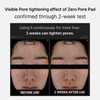 Mirco Pore Pads (AHA + BHA) |Acne-prone skin care