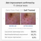 Mirco Pore Pads (AHA + BHA) |Acne-prone skin care