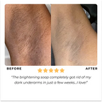 Turmeric & Kojic Acid Brightening Soap