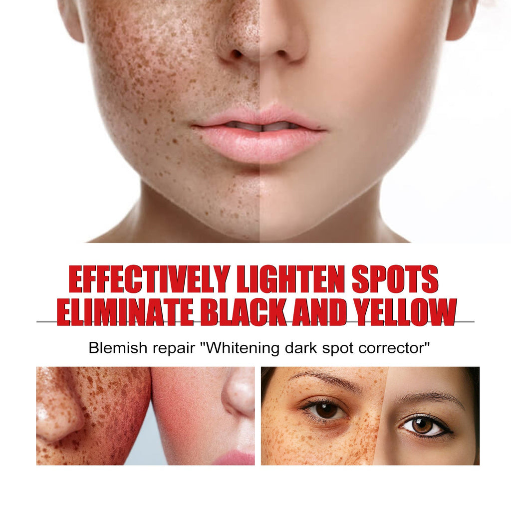 Spot-Fade Brightening Ampoule Serum