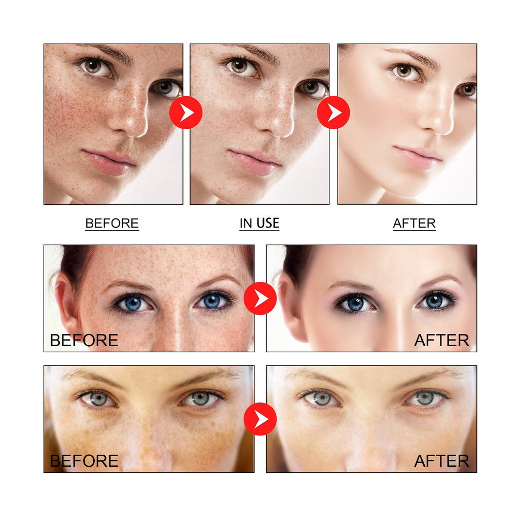 Spot-Fade Brightening Ampoule Serum