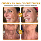 Botox Bee Venom Wrinkle Removal Cream-Last Day Promotion 75% OFF