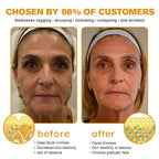 Botox Bee Venom Wrinkle Removal Cream-Last Day Promotion 75% OFF