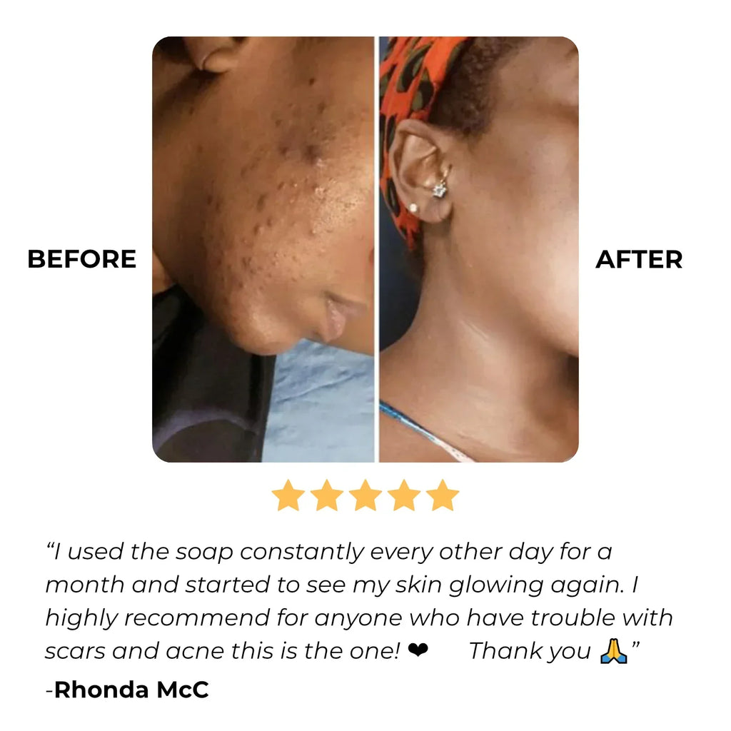 【Recommended by American Nutritionists】Golden Sleep Tablets - Contains Melatonin, L-Theanine, and 5-HTP to Promote Scientific Sleep, Reduce Stress, and Maintain a Healthy Lifestyle