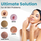 【Acne & Scar Therapy Set】 2% Salicylic Acid + High-Strength VC Essence