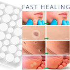 Acne sticker-Used for reducing inflammation on acne spots