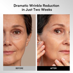 GLOW Wireless LED Face Mask，Portable and Rechargeable