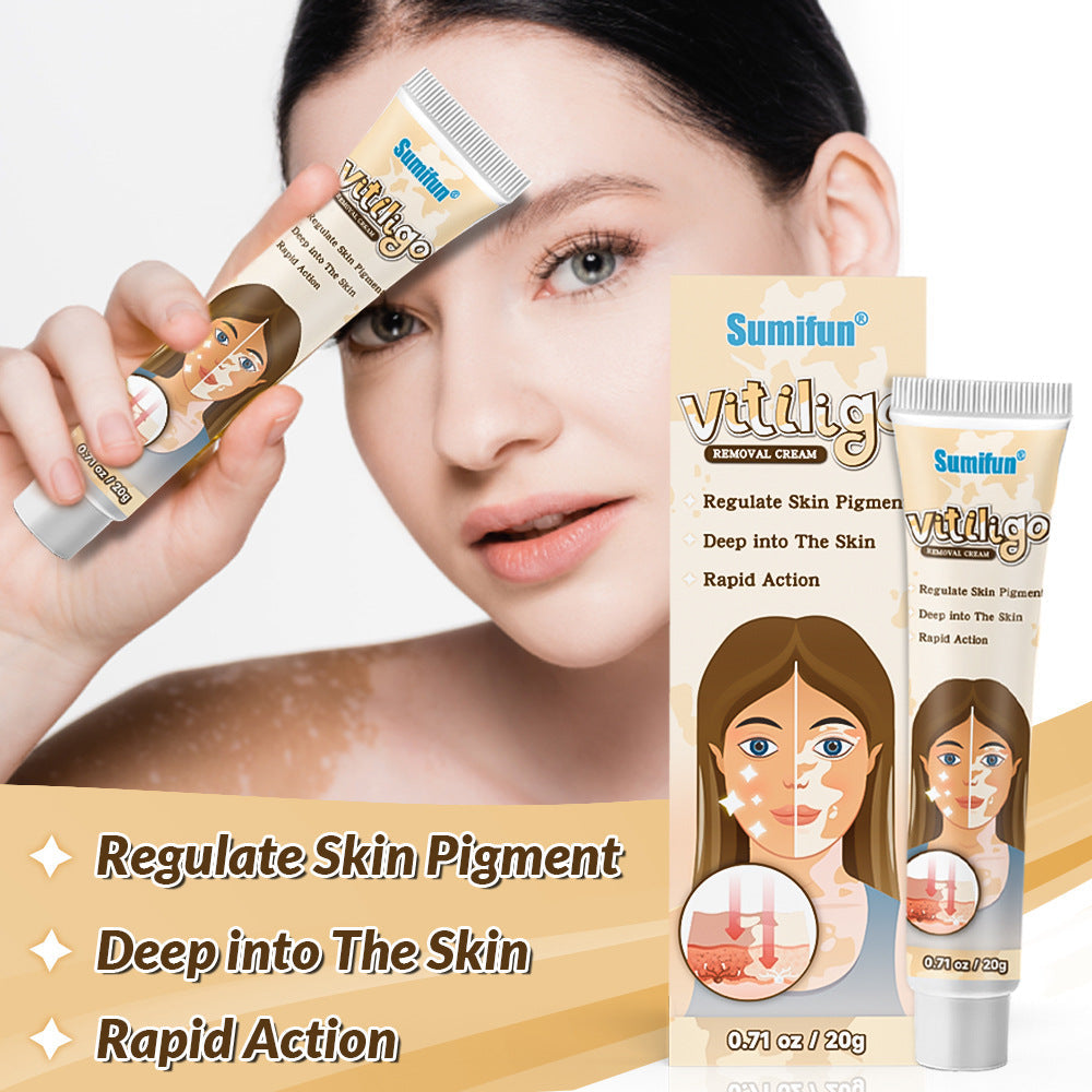 Vitiligo Repair Cream