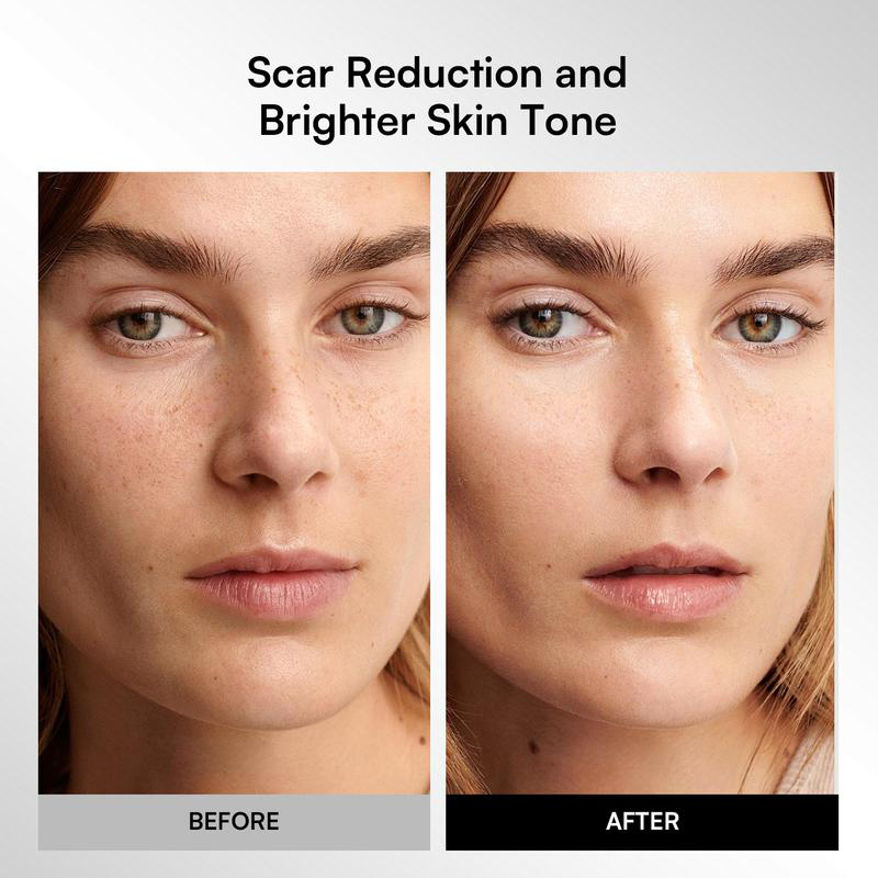 GLOW Wireless LED Face Mask，Portable and Rechargeable