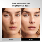 GLOW Wireless LED Face Mask，Portable and Rechargeable