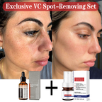 【Dermatologist-Recommended】 VC Spot-Correction & Whitening Cream Set