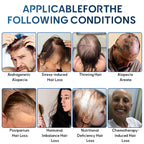 ✅🇺🇸 Developed by Trichologists：High-Concentration Minoxidil Hair Regrowth Serum