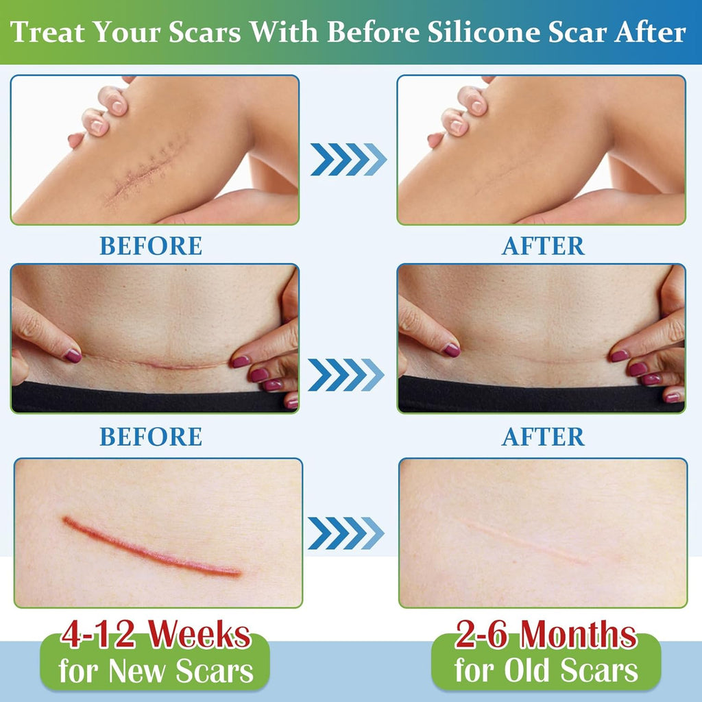 Scar Solution Set – Scar Cream Gel + Silicone Scar Tape