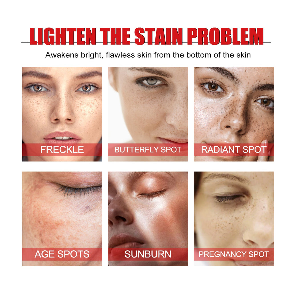 Spot-Fade Brightening Ampoule Serum