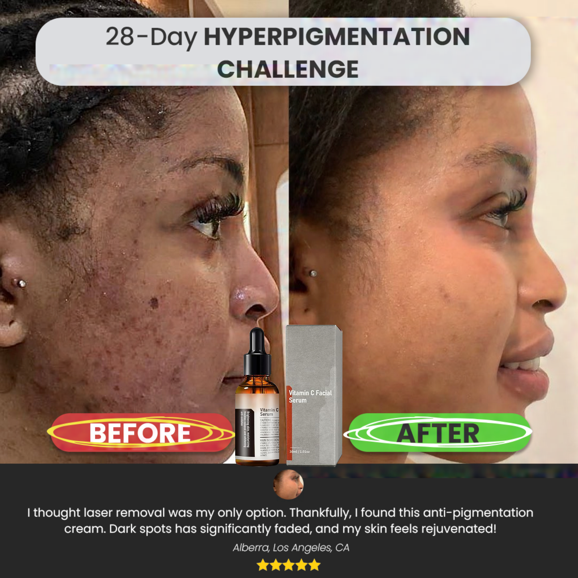 【Dermatologist-Recommended】 VC Spot-Correction & Whitening Cream Set