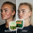 Korean Skincare Toner Pads – Anti-Aging, Dark Spot & Wrinkle Care with Snail Mucin & Peptides (100 ct)