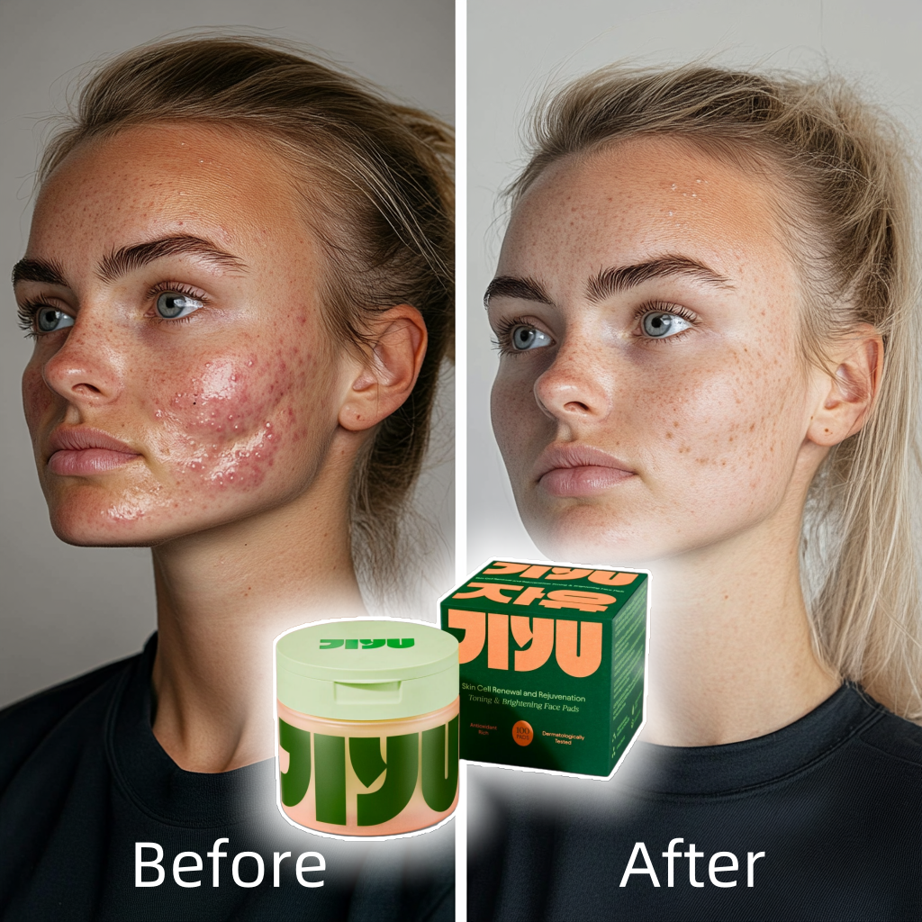 Korean Skincare Toner Pads – Anti-Aging, Dark Spot & Wrinkle Care with Snail Mucin & Peptides (100 ct)