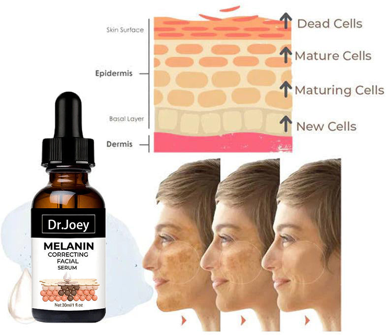 ✨Fast Dark Spot Remover- Melanin Correcting Facial Serum