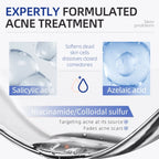 Acne Drying Lotion – Fights Inflamed & Pus-Filled Pimples Fast