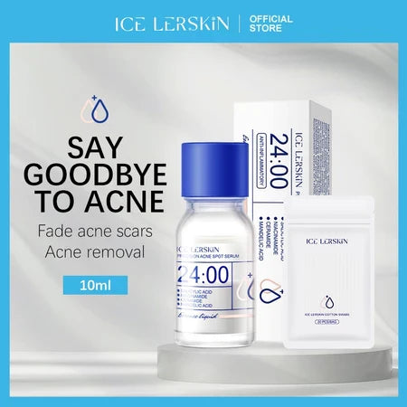 Acne Drying Lotion – Fights Inflamed & Pus-Filled Pimples Fast