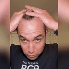 Anti-Hair Loss Ampoule